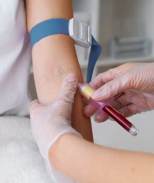 Karyotyping recommended